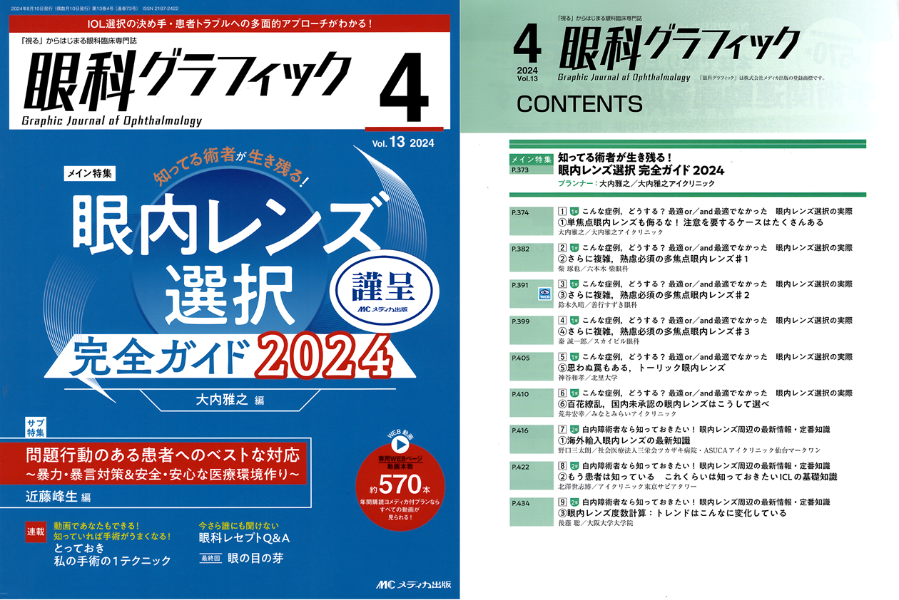 眼科グラフィック４