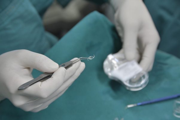 ICLのデメリットとは？後悔しないために知っておくべき注意点